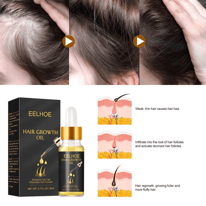 💥LAST DAY PROMOTION 50% OFF - 🔥EXPERTS RECOMMEND PRODUCT🔥HAIR GROWTH OIL