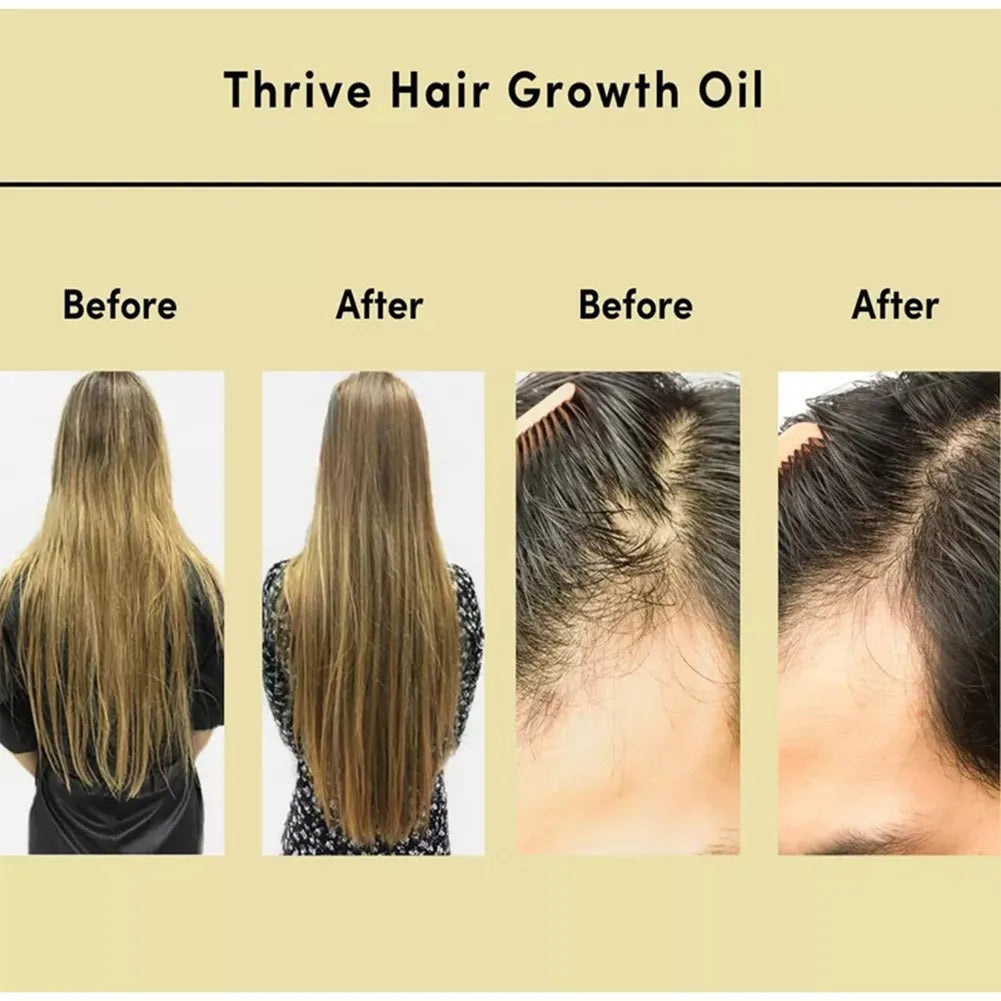 🔥LAST DAY 50% OFF🔥Natural Hair Growth Oil